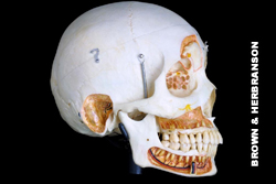 Anatomia do Dente e Mandíbula Inferior de um Jovem 6 Partes